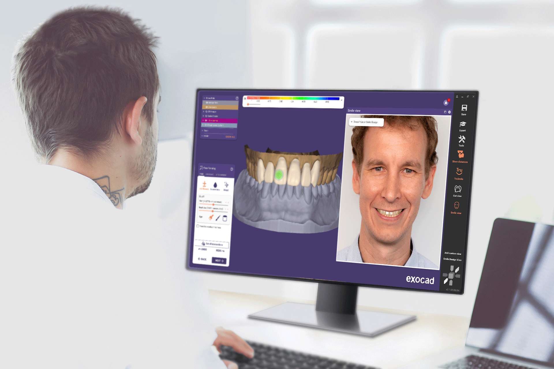 DentalCAD Rijeka 3.1 Smile Design