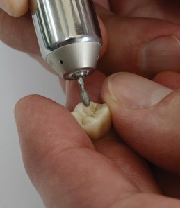 adjusting and polishing a tooth