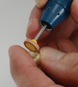 sanding a tooth