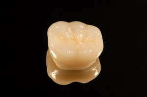 polished tooth